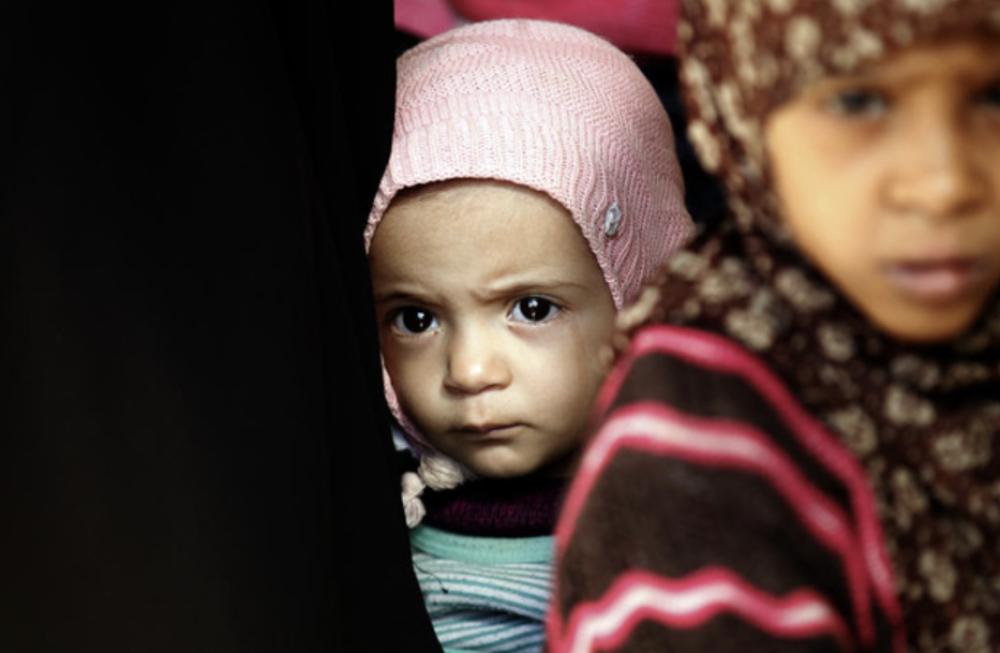 5,000 children killed or injured in Yemen war, UN Says