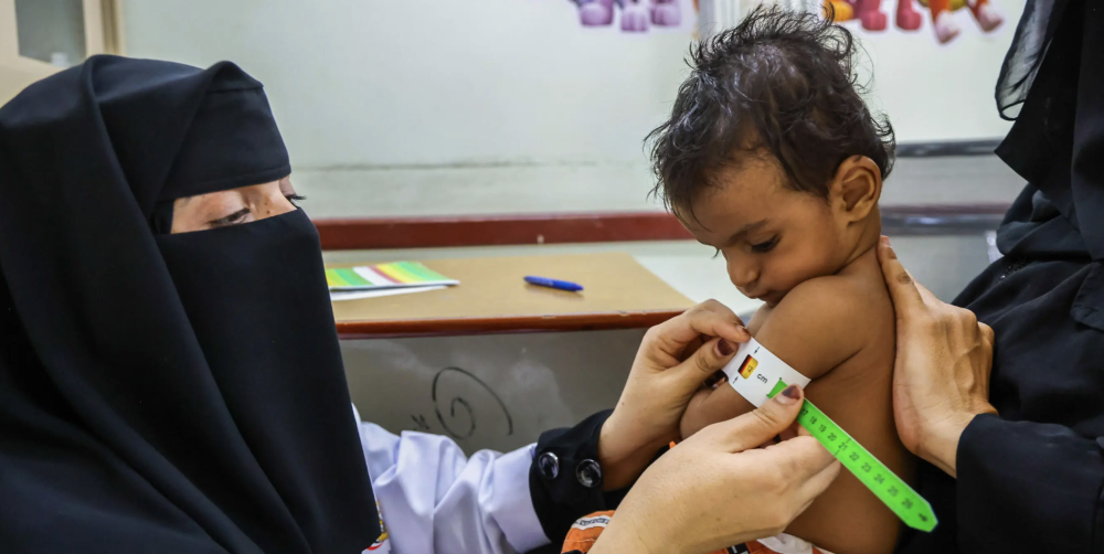 Yemen : OCHA urges Security Council to prevent starvation