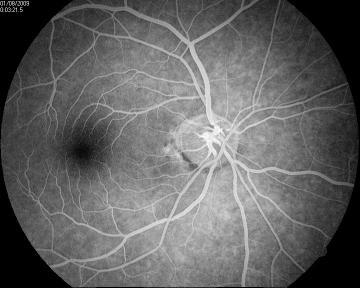 Yemeni Peace Talks Sabotaged by United States Supported Elements in Geneva