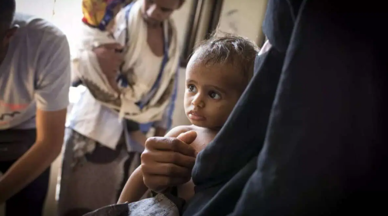 Malnutrition is ‘crisis inside the crisis’ in Yemen: NGO