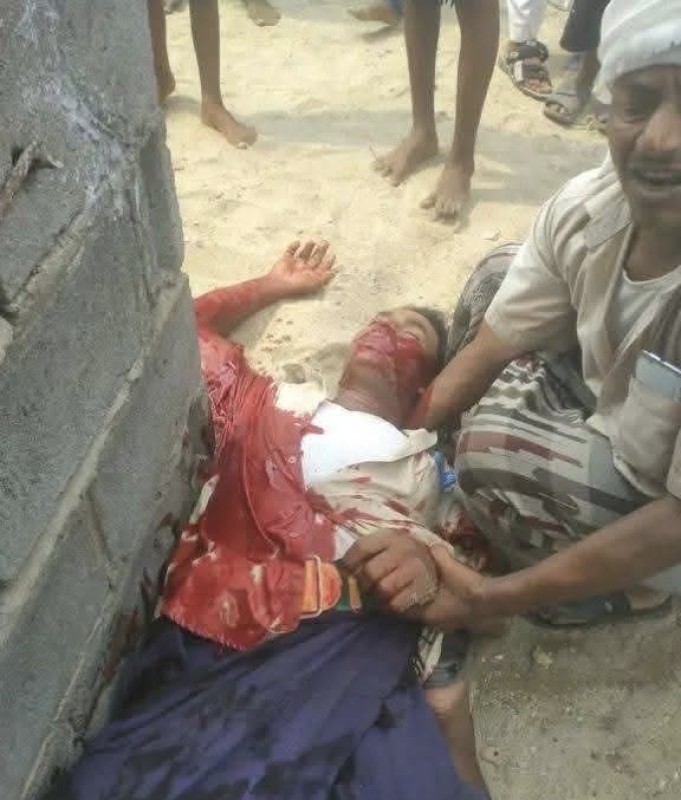 ‎‏Houthi Gunman Kills Unarmed Displaced Man While Receiving Aid in Hodeidah West of Yemen